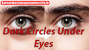 Dark Circles Under Eyes