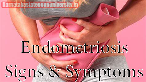 Endometriosis Signs & Symptoms