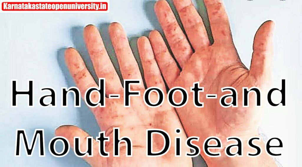 Hand-Foot-and-Mouth Disease Causes, Symptoms, Diagnosis & Treatment
